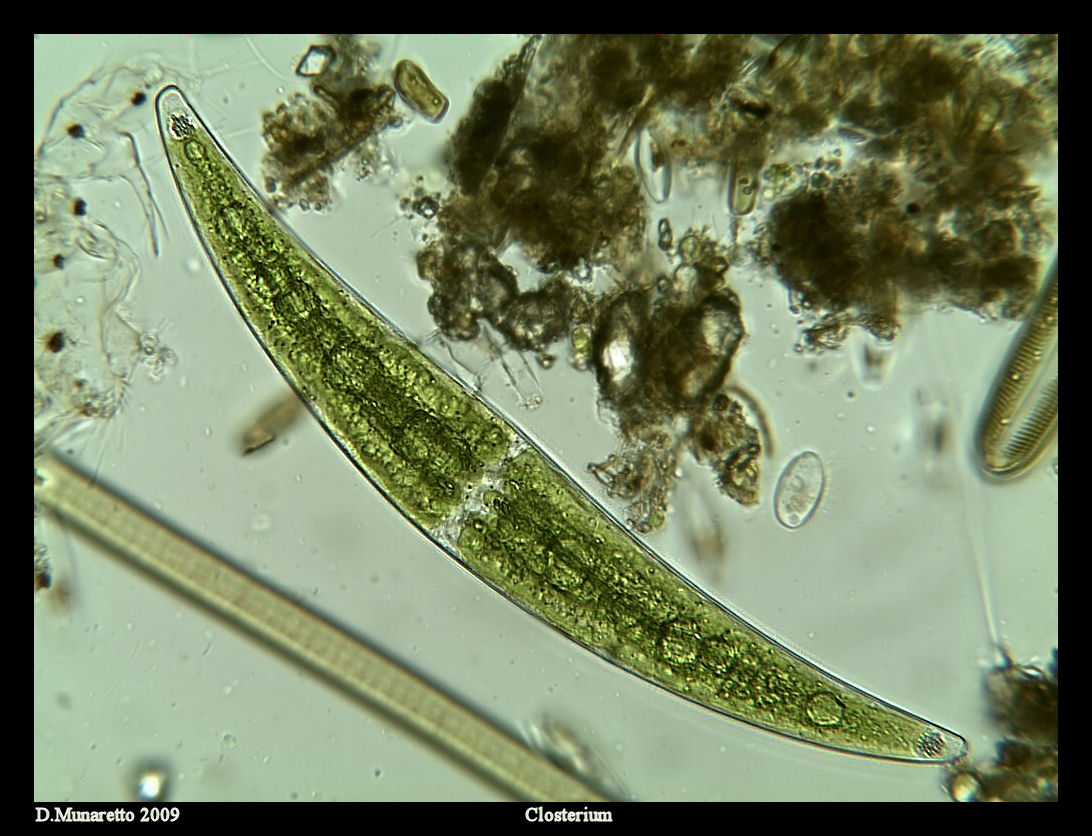 Closterium da identificare